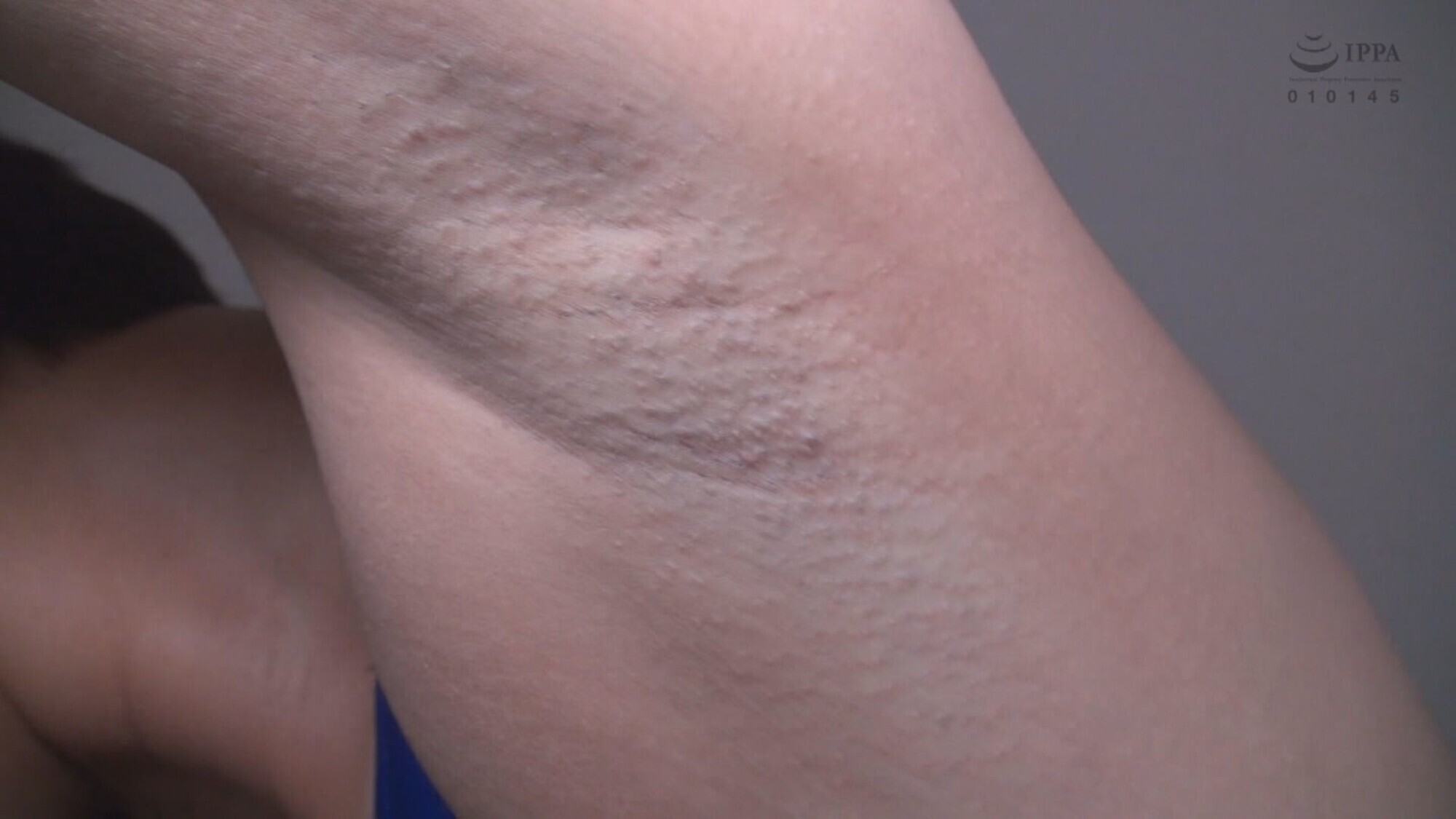 阿部乃みく こんな可愛い子がハミ毛！？ 毛穴まで見える大接写＆フェラ抜きザーメン水着垂らし