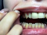 喉ちんこが可愛いゆのちゃんの口内観察